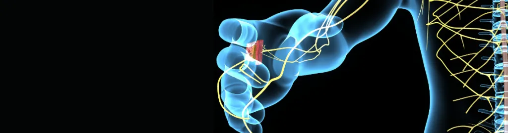 Illustration of Different Categories of Peripheral Neuropathy Displayed in a Chiropractic Clinic