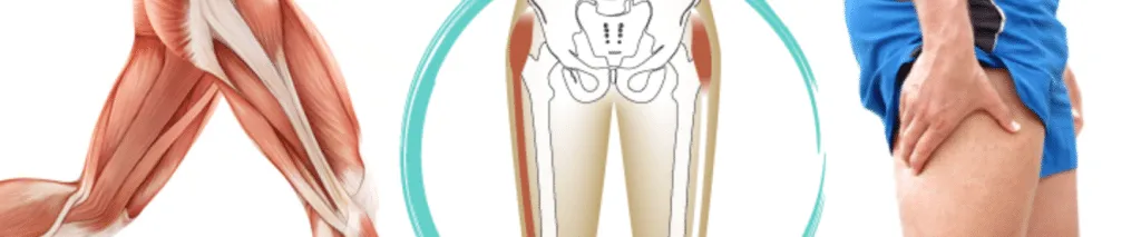 Chiropractor Demonstrating Treatment for Iliotibial Band Tightness in a Patient at a Clinic